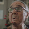 Người đàn ông bị biến dạng khuôn mặt sau 54 năm hút thuốc