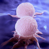 Bệnh nhân ung thư vú có thể tránh ‘ác mộng’ di căn nhờ phát hiện mới