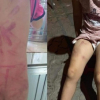 Quảng Nam: Làm rõ nghi vấn bé gái 6 tuổi bị bà đánh đập gây thương tích đầy mình