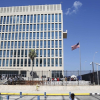 Phát hiện bất thường trong não nhân viên ngoại giao Mỹ ở Cuba