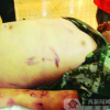 Trung Quốc:  Kinh hoàng các trung tâm cai nghiện game gây chết người