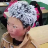 Cậu bé tóc băng Trung Quốc chỉ được nhận hỗ trợ 1.250 USD