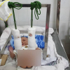 Bé trai 4 tháng tuổi nghi bị bố đánh đến xuất huyết não, gãy chân