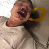 Hà Nội: Nhóm côn đồ đánh người ngay trong trụ sở UBND xã