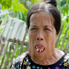 Người phụ nữ gần 50 năm không ngậm được miệng
