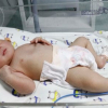 Hạ thân nhiệt cứu sống bé trai sơ sinh thiếu oxy não