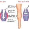 Đứng làm việc 8 giờ mỗi ngày, nữ điều dưỡng mắc bệnh không ngờ