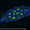 Thí điểm thả muỗi Wolbachia trên diện rộng để diệt muỗi sốt xuất huyết