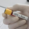 Ca nhiễm HIV được chữa khỏi thứ 3 trên thế giới