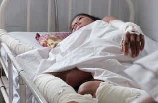 Mẹ con thai phụ bỏng nặng được bệnh viện cưu mang