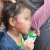 Bé gái 5 tuổi nghi bị bảo mẫu tát sưng mặt ở Sài Gòn