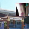 22 học sinh bị giáo viên đánh tím chân: Bộ GD&ĐT lên tiếng