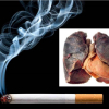 Ung thư phổi nguy hiểm thế nào