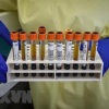 Italy thử nghiệm thành công kháng thể chống virus SARS-CoV-2