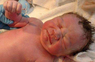 Thực hư ảnh em bé chào đời cầm chặt vòng tránh thai trên tay