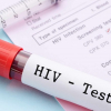 Quy trình xét nghiệm khẳng định nhiễm HIV thế nào?