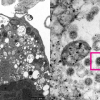 Hình ảnh kính hiển vi đầu tiên về biến thể Omicron được công bố