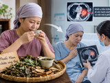 Bỏ phác đồ của bác sĩ để uống thuốc Nam chữa ung thư, 6 tháng sau đã di căn