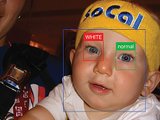 Ứng dụng điện thoại phát hiện sớm bệnh mắt
