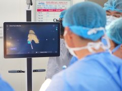 Đọc nhanh bài viết 211913