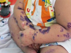 Đọc nhanh bài viết 211984