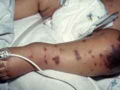 Đọc nhanh bài viết 212256