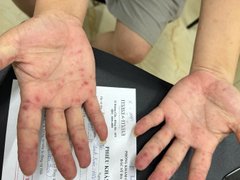 Đọc nhanh bài viết 212311