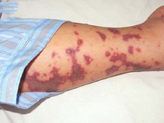 Đọc nhanh bài viết 212908