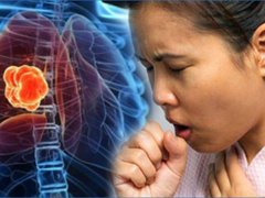 Đọc nhanh bài viết 213222