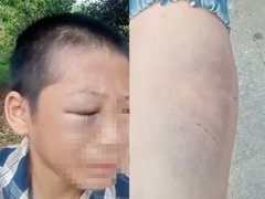 Đọc nhanh bài viết 213976