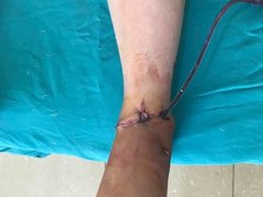 Ảnh bìa bài viết 82480