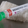 Vi sao bệnh đậu mùa khỉ đột ngột lây lan trên thế giới và liệu virus đã biến đổi?