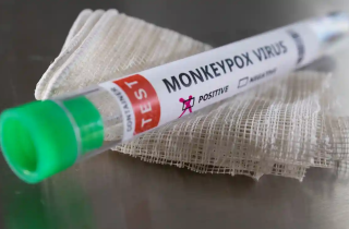 Vi sao bệnh đậu mùa khỉ đột ngột lây lan trên thế giới và liệu virus đã biến đổi?