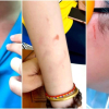 Học sinh trường quốc tế ở TP.HCM bị bạn đánh: Bộ GD&ĐT chỉ đạo khẩn