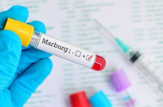 Giám sát chặt nguy cơ lây lan virus Marburg vào Việt Nam