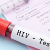 Bộ Y tế vào cuộc vụ tự ý lấy máu của học sinh để xét nghiệm HIV