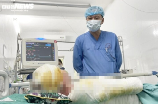 Bác sĩ gần 20 năm giành sự sống cho những bệnh nhân bỏng thập tử nhất sinh