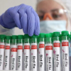 WHO xác nhận ca tử vong đầu tiên do cúm gia cầm A/H5N2