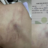 'Giáo viên hay kẻ ác nhân mà đánh trẻ không biết ghê tay'