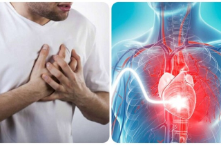Biểu hiện truỵ tim mạch bạn không nên chủ quan