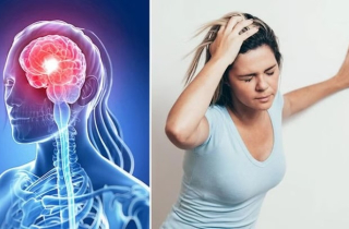 Lối sống xấu khiến đột quỵ gia tăng ở người trẻ