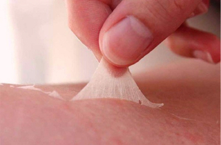 Bỏng da, rôm sảy do nắng nóng, bác sĩ khuyến cáo cách phòng tránh