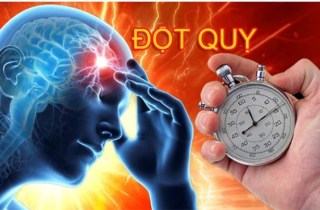 Ăn uống lành mạnh giúp phòng ngừa đột qụy
