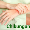 Nhóm người nguy cơ mắc bệnh Chikungunya