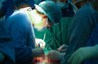 40 bác sĩ, 7 giờ mổ và quyết định táo bạo cứu người suy tim-phổi giai đoạn cuối