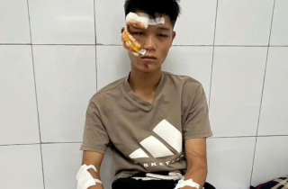 Lời khai của quái xế đi vào đường cấm phục vụ A80, tông cảnh sát cơ động