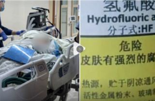 Giẫm phải ‘nước hòa tan xương’ khi đi dạo, người phụ nữ chết sau 5 ngày