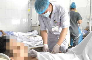 Xương cá đâm thủng ruột non, gây áp xe ổ bụng