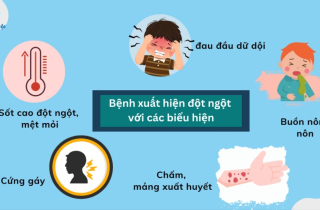 Khuyến cáo phòng chống dịch bệnh Viêm não mô cầu