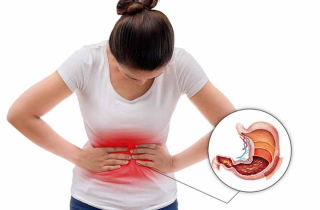 Viêm loét dạ dày: Thông tin bệnh học tổng quan từ A-Z